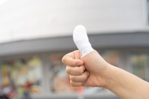 woman giving a thumbs-up in a cast