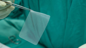 What Are the Side Effects of Hernia Mesh
