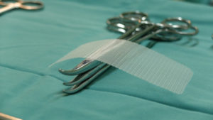 What Complications Are Linked To Hernia Mesh?