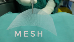 What Does Hernia Mesh Do to Your Stomach?